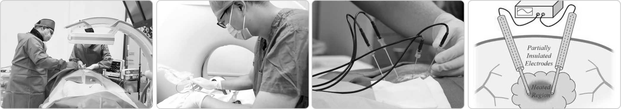 1735892063712793.jpg ABLATION NEEDLES3.jpg