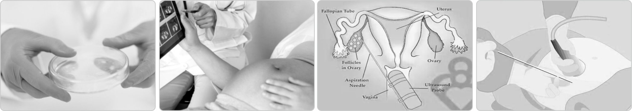 1736143244508441.jpg IVF RANGE5.jpg