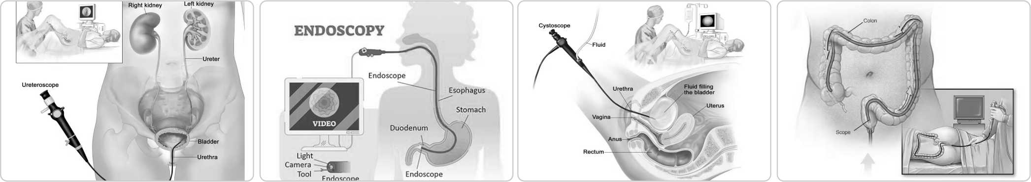 1736150853190973.jpg ENDOSCOPIC2.jpg